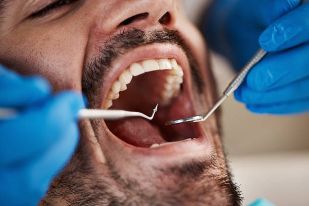 Best Emergency Wisdom Teeth Removal in New Kingman Butler, AZ