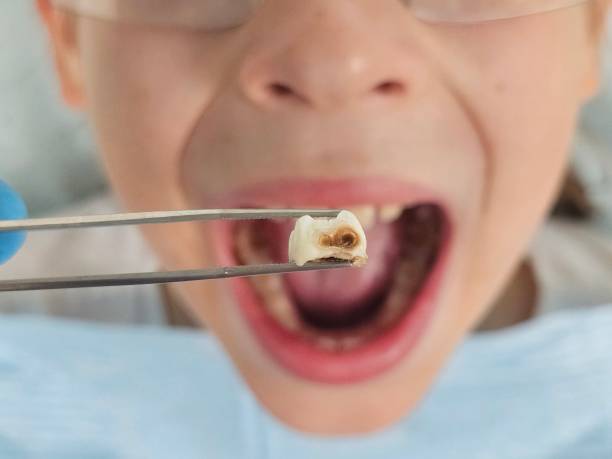 Best Emergency Tooth Extraction in New Kingman Butler, AZ